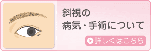 斜視の病状・手術について